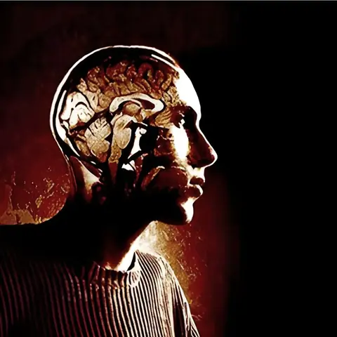 اضطرابات الدماغ