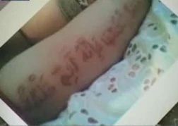 آيات قرآنية على جسد رضيع