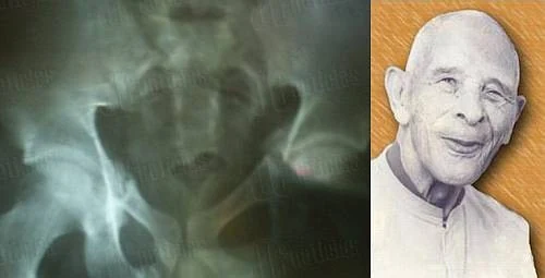 صورة أشعة إكس